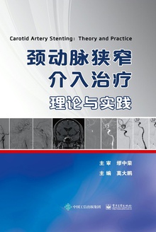 颈动脉狭窄介入治疗:理论与实践